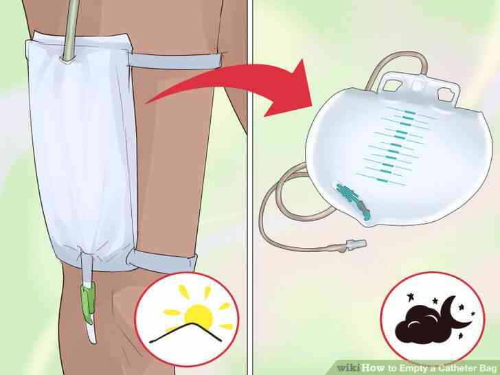 Image intitulée Vide un Cathéter Sac Étape 7